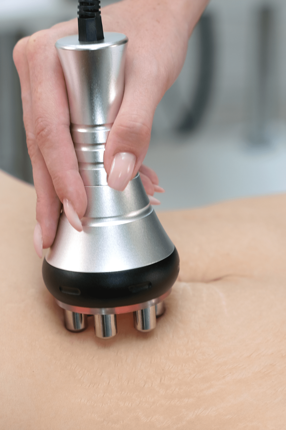 Maeve Radiofrequency (RF) Therapy