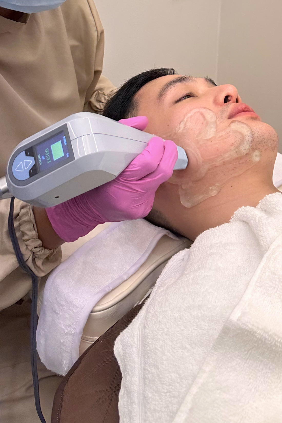 Maeve Radiofrequency (RF) Therapy