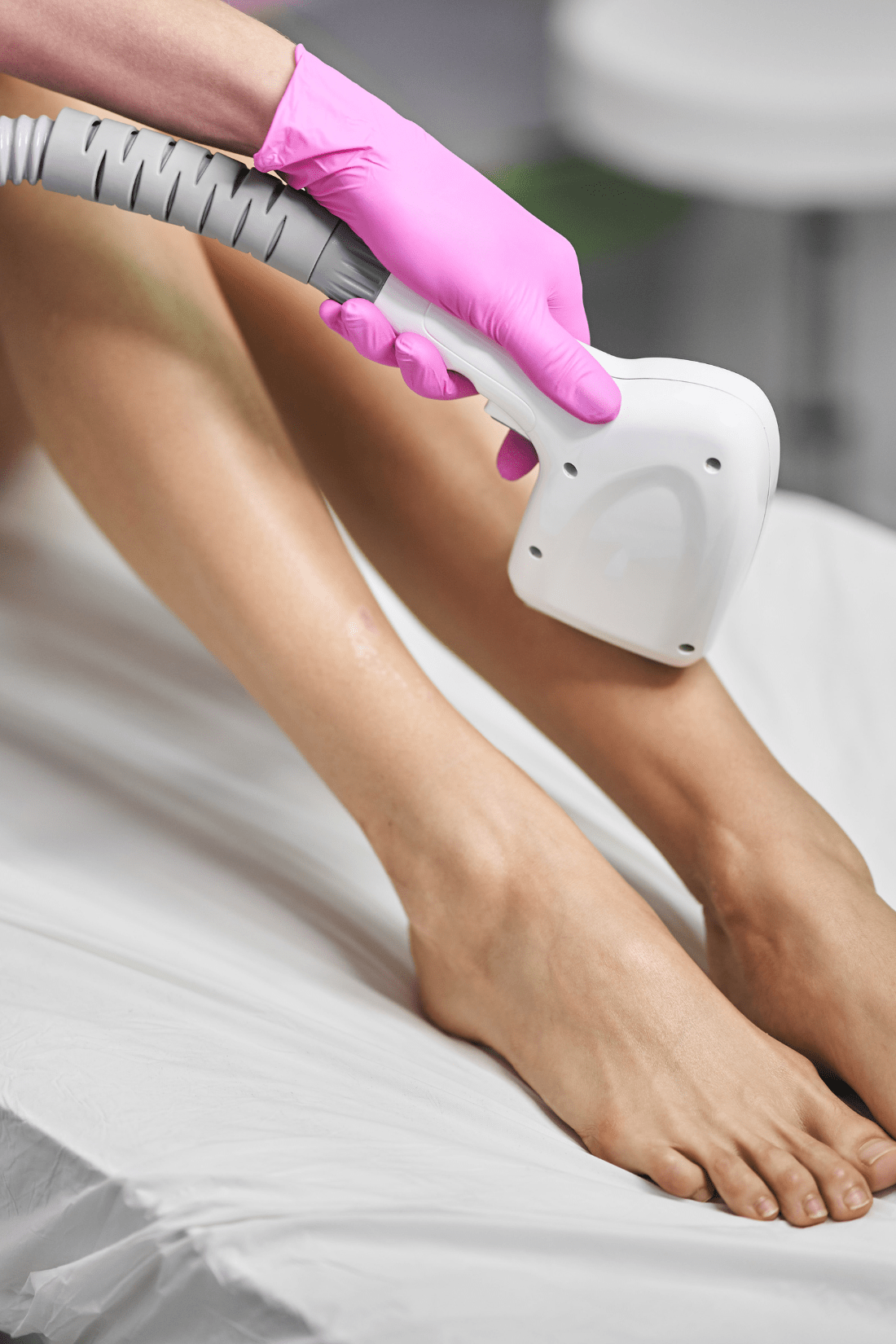 Diode Laser Hair Removal