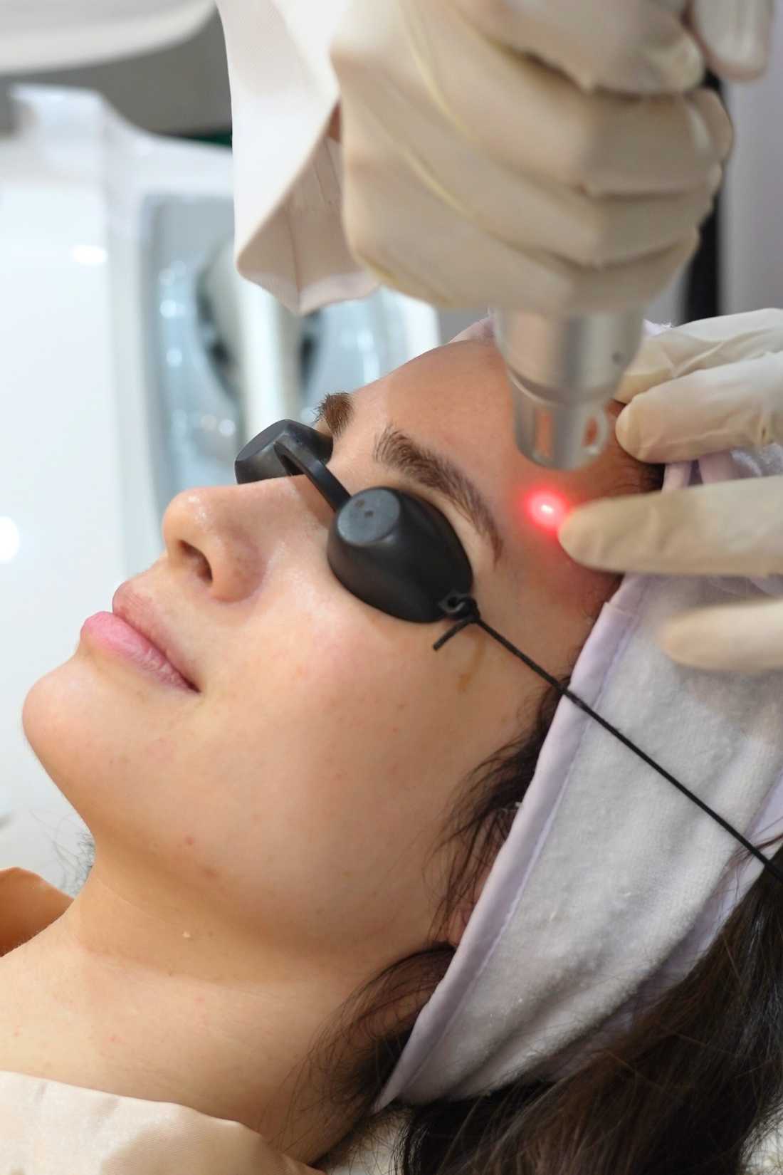 Picoluxe Whitening Laser